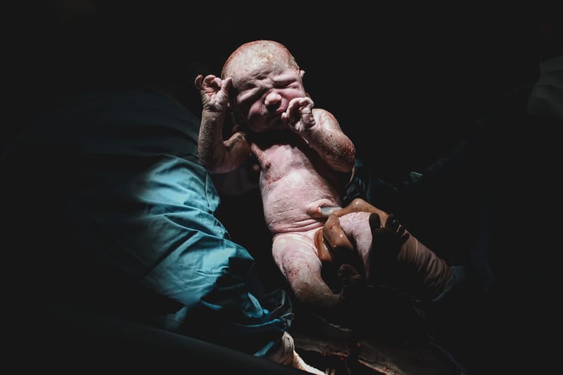 C-Section