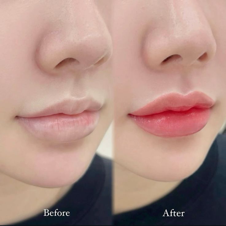 COMBO 3_TRẺ HOÁ MÔI -  TĂNG SINH COLLAGEN - DA SÁNG MƯỚT