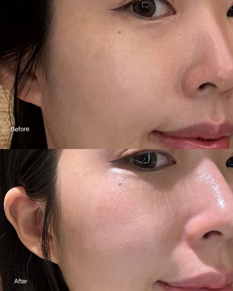 COMBO 4_TÁI TẠO NỀN DA - DA CĂNG MỌNG - MẮT SÁNG GIẢM QUẦNG THÂM