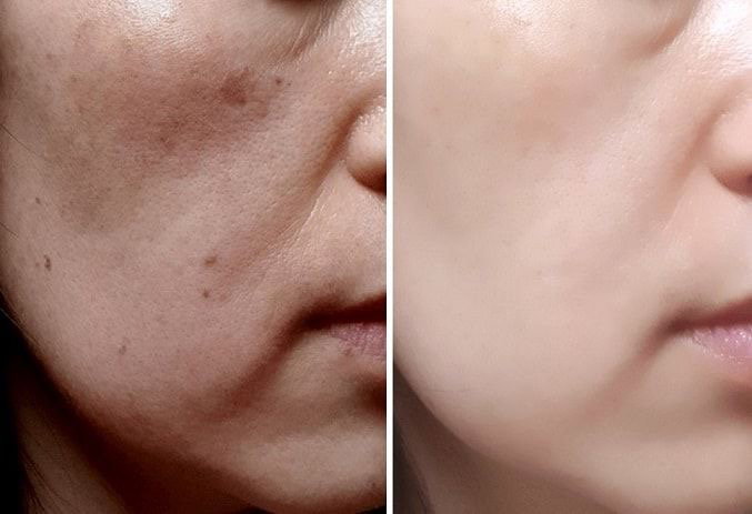 COMBO 5_NÂNG CƠ MẶT TỰ NHIÊN - TRUYỀN SÁNG - HỒI SINH VÙNG MẮT