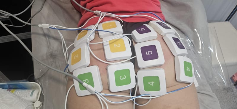 TrueFLEX izomstimulációs kezelés