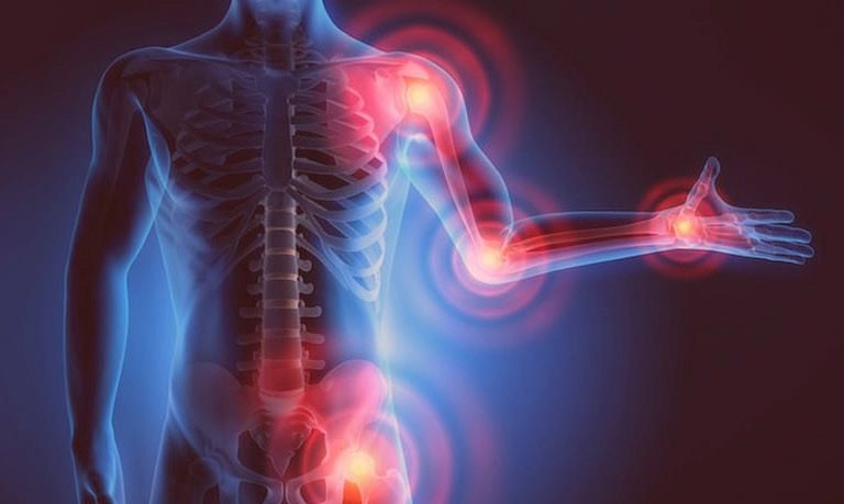 Corrective Exercise and Movement