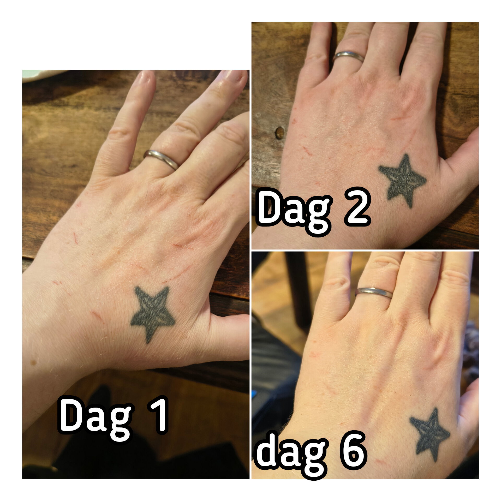 Before and after using Aloe vera gel for dry hands