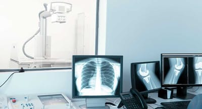 Digital X-Ray – Fast, Accurate, and Safe Imaging