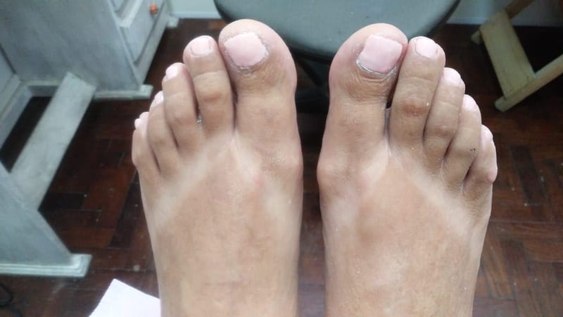 Implantes Temporales