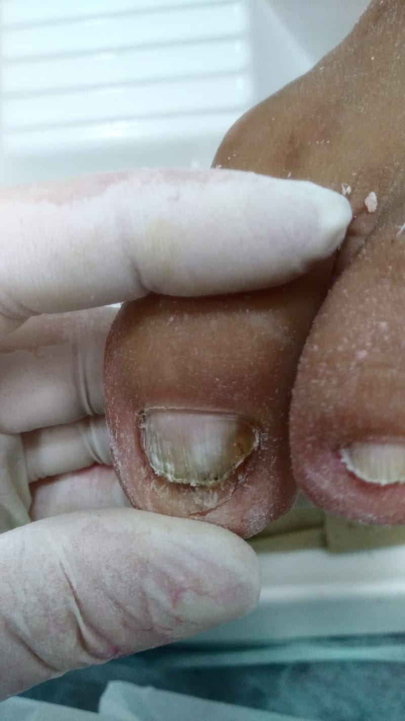 Implantes Temporales