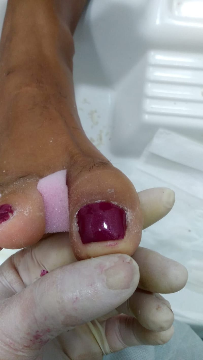 Implantes Temporales