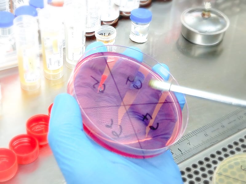 Aseptic Processing and Contamination Control Under EU GMP Annex 1: Practical Applications for Modern Sterile Operations