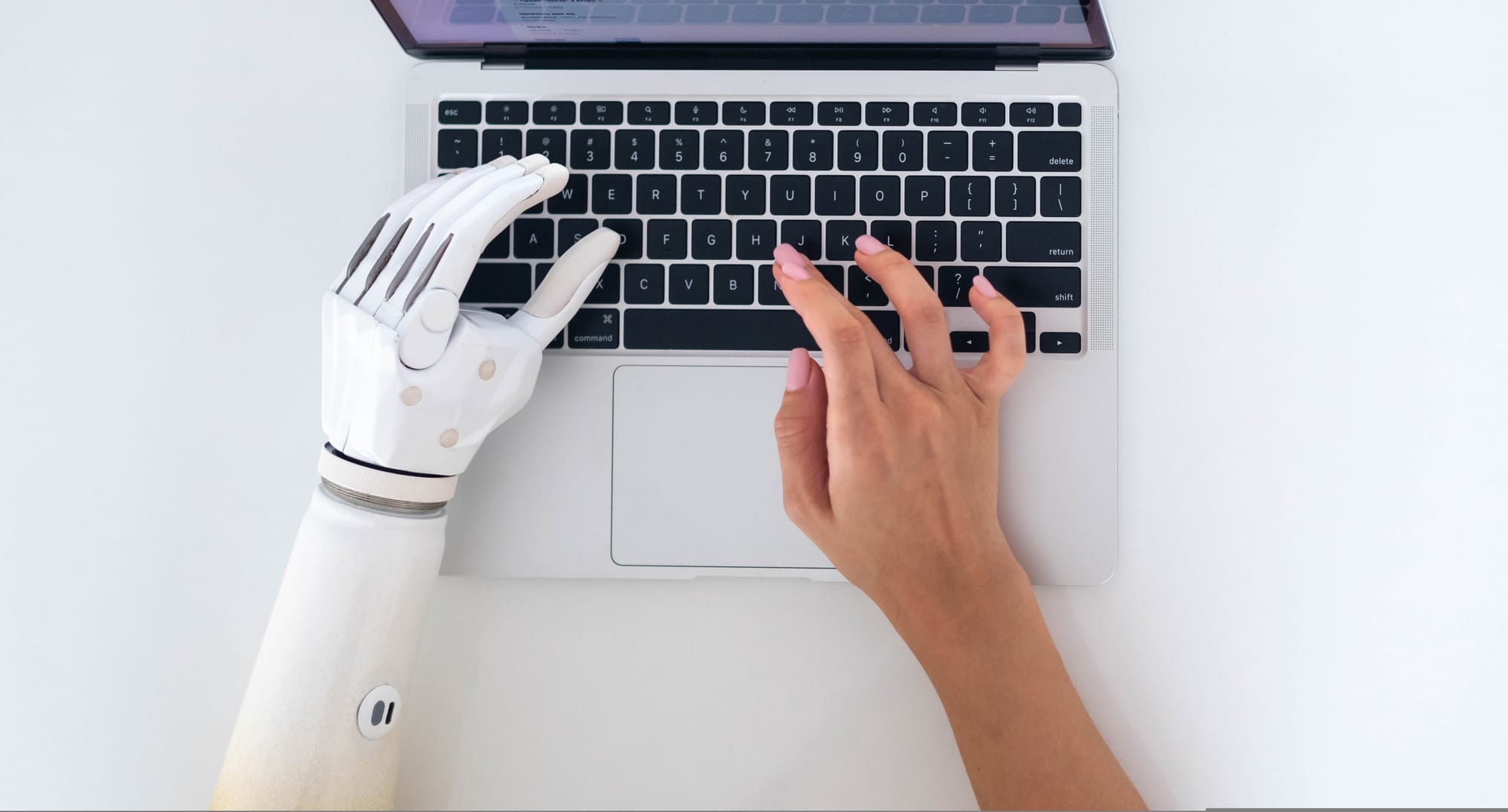 POVIJEST ASISTIVNE TEHNOLOGIJE