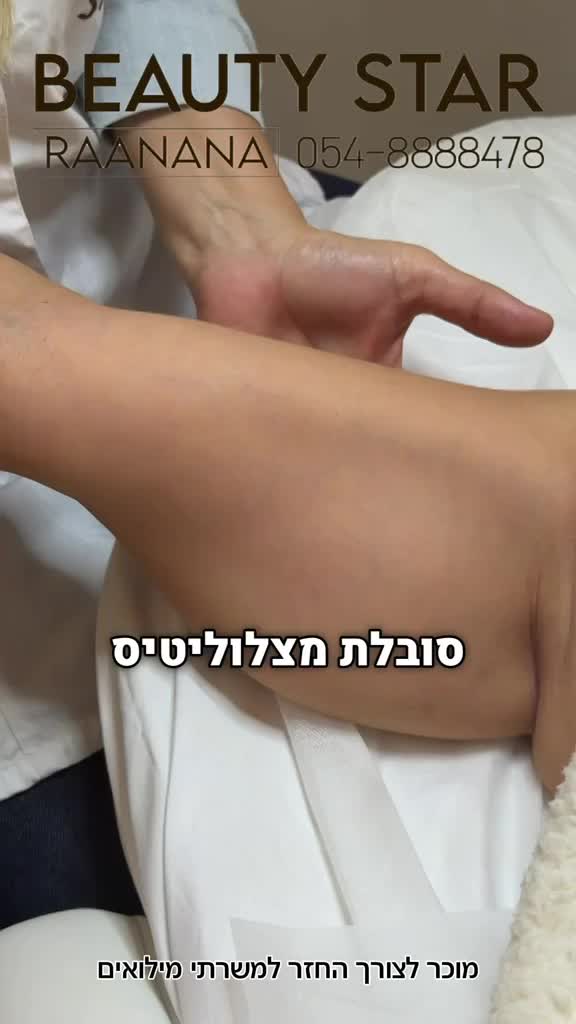 טיפולי צלוליט