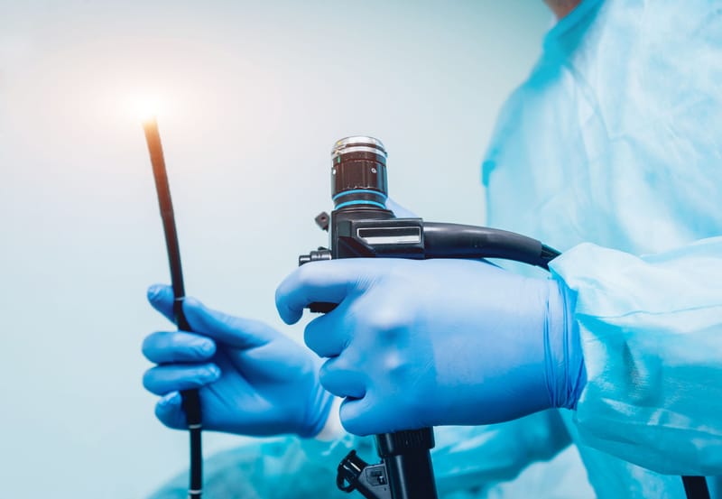 ENDOSCOPY
