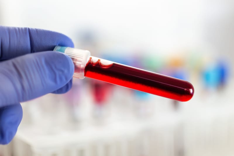 Blood Analysis