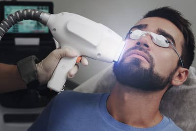 ازالة الشعر بالليز للرجال