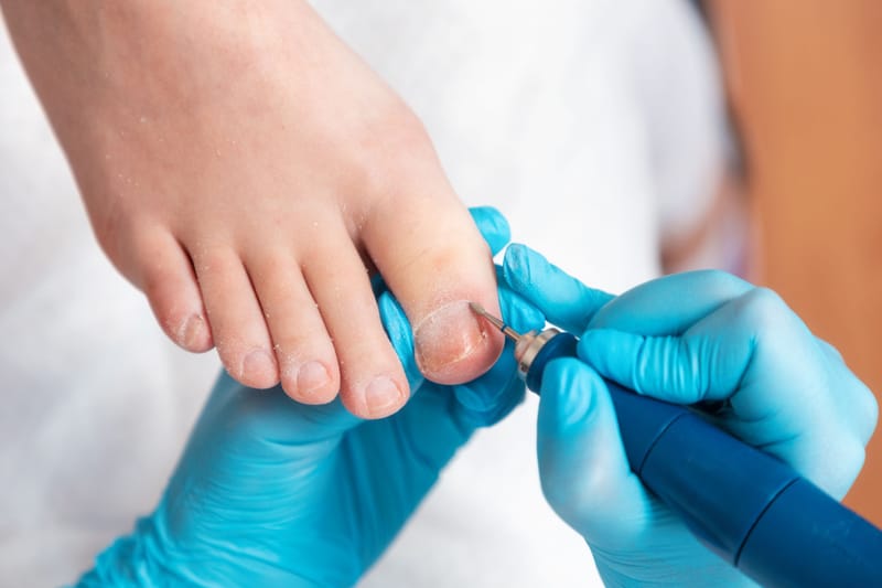 Podiatry care