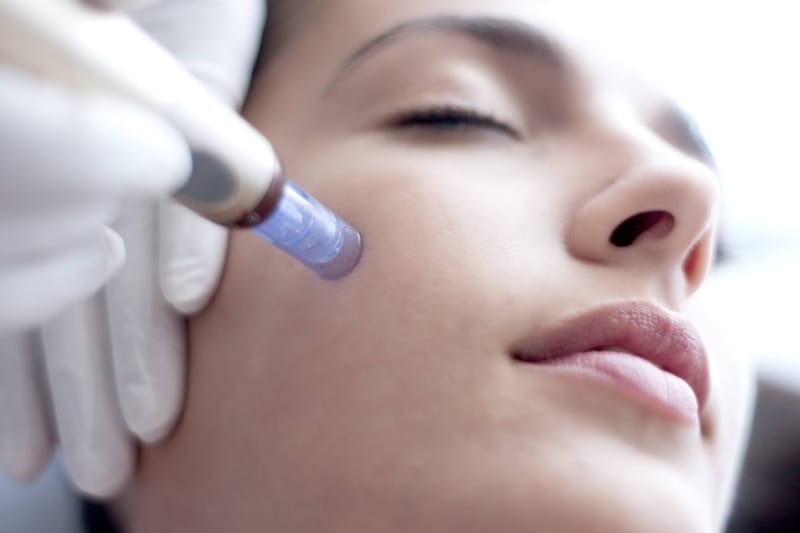 Dermapen con exosomas