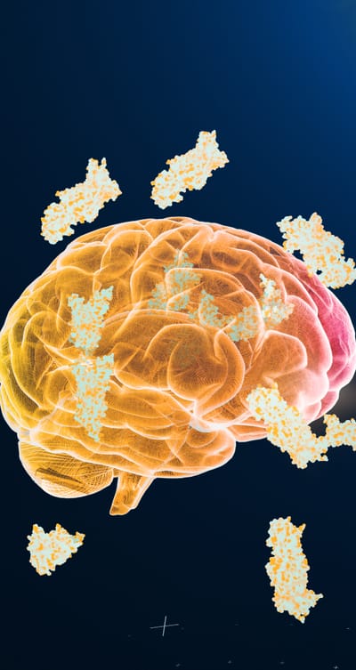 Cientistas identificam novo gatilho do Alzheimer e criam composto capaz de bloqueá-lo