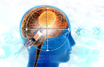 Vacina experimental contra tumor cerebral impede volta do câncer em 42% dos pacientes; estudo
