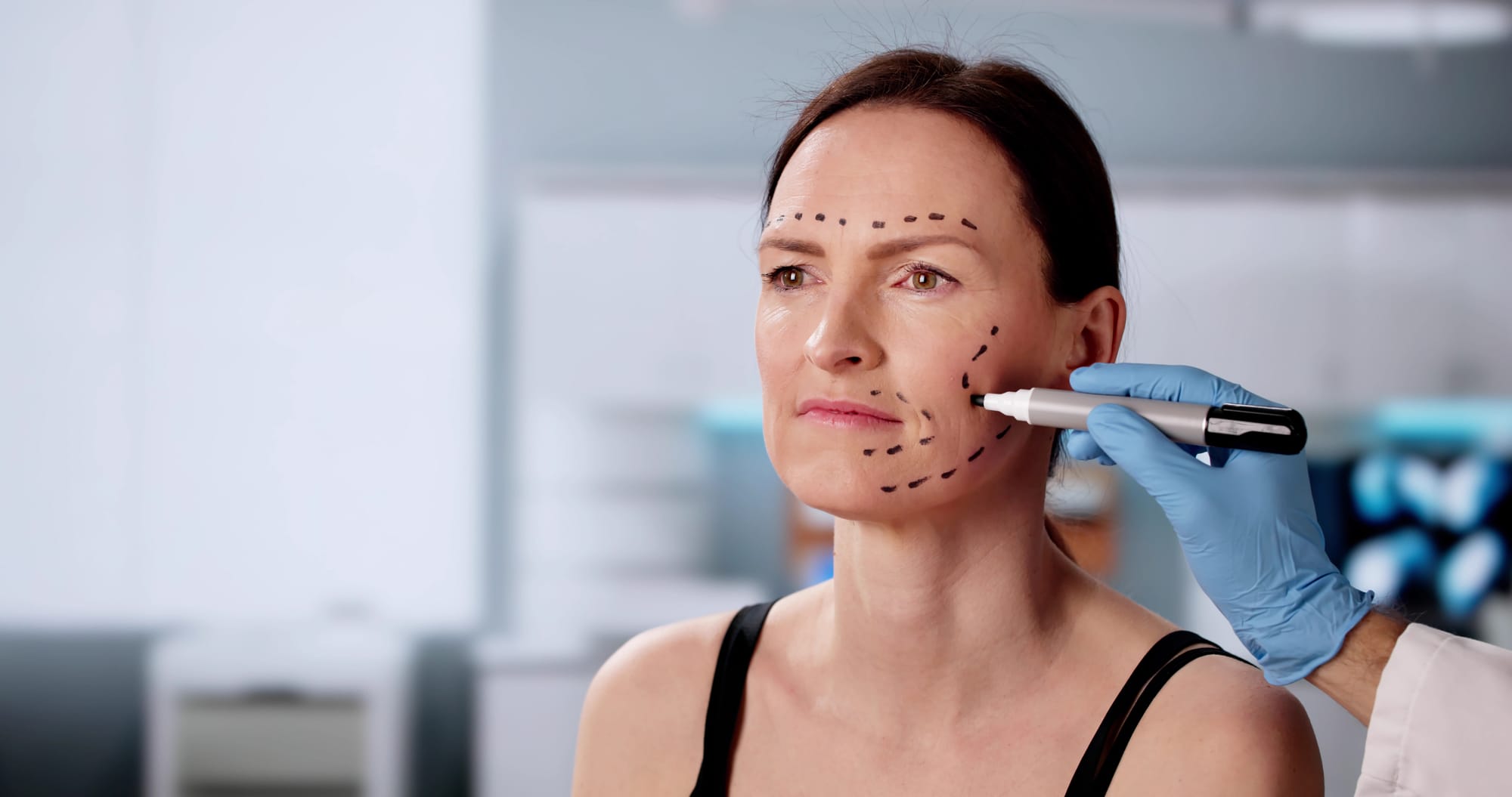12 questions and answers regarding a facelift (rhytidectomy) in Istanbul, Turkey,