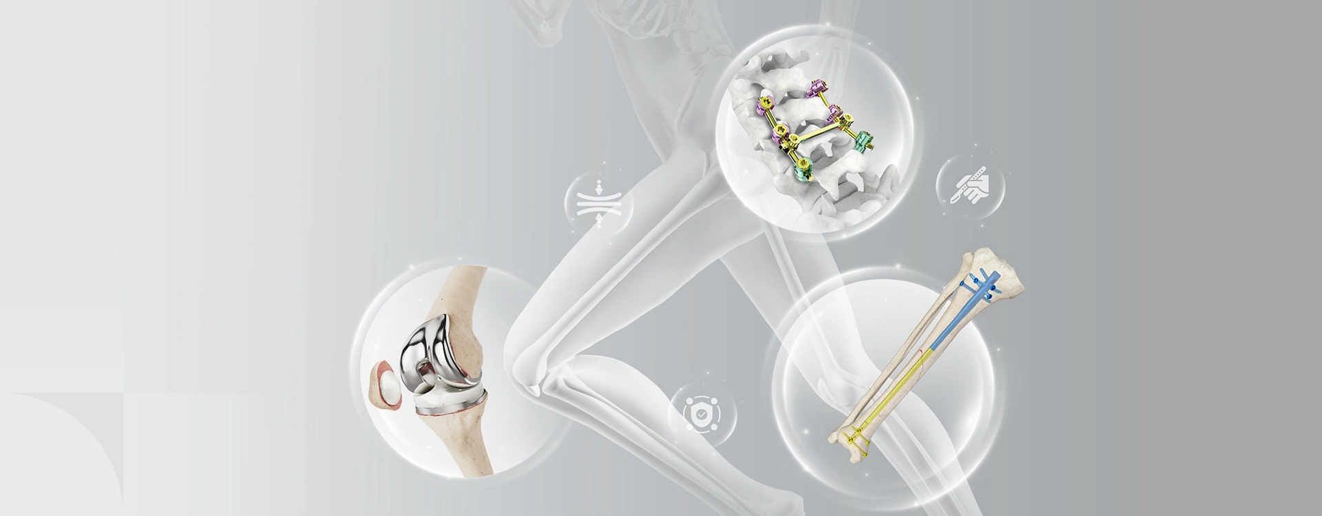 MK-PS Knee Joint Prosthesis
