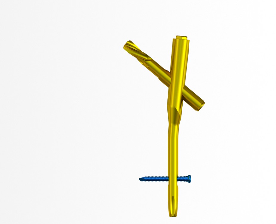 MR Hollow Tibial Intramedullary Nail Type III