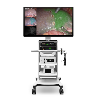 Laparoscopic system