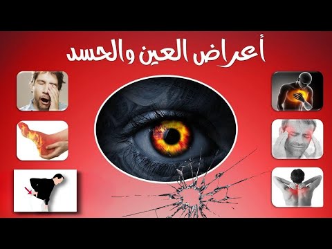 علامات العين والحسد وكيف يمكن التمييز بينها وبين التعب النفسي