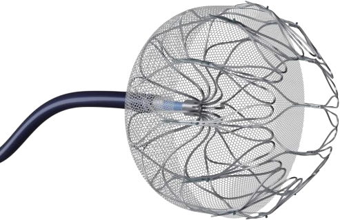 Left atrial appendage occlusion device