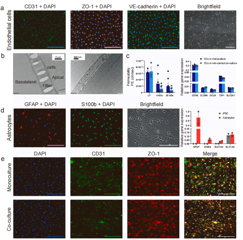 Biotransformation of nanoplastics in human plasma and their permeation through a model in vitro blood-brain barrier: An in-depth quantitative analysis