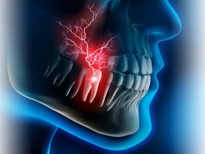 Endodoncia