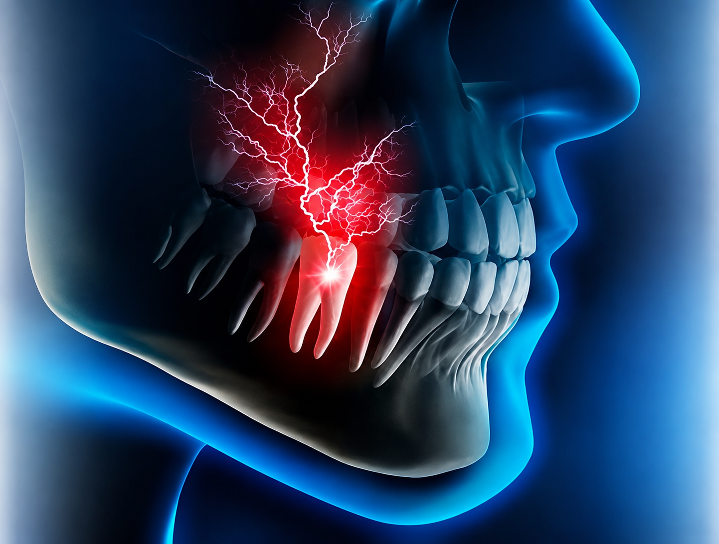 Endodoncia