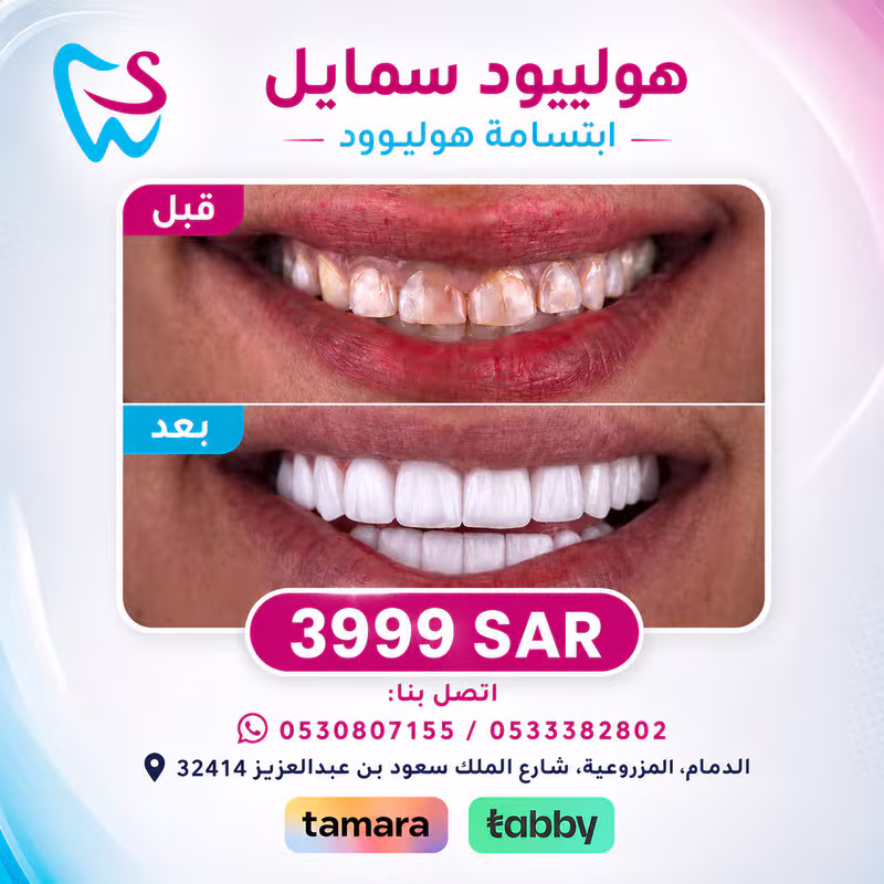 عرض 1