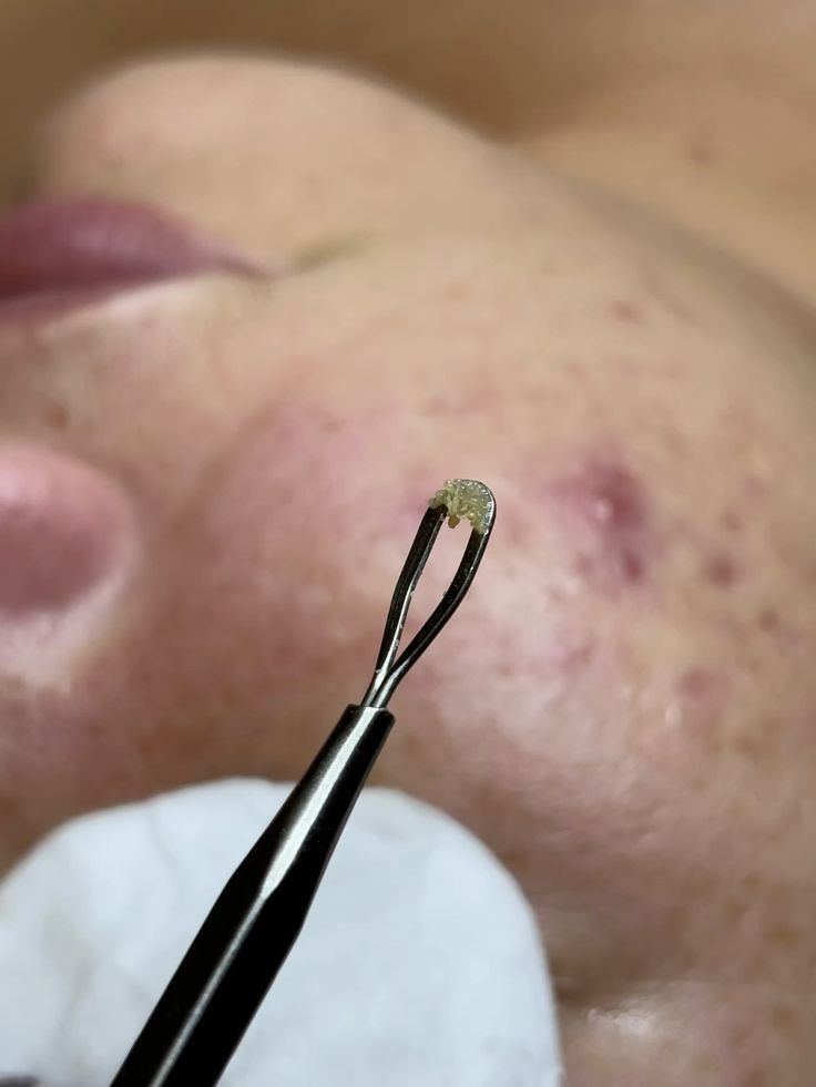 Trat. Cosmetice și corporale 