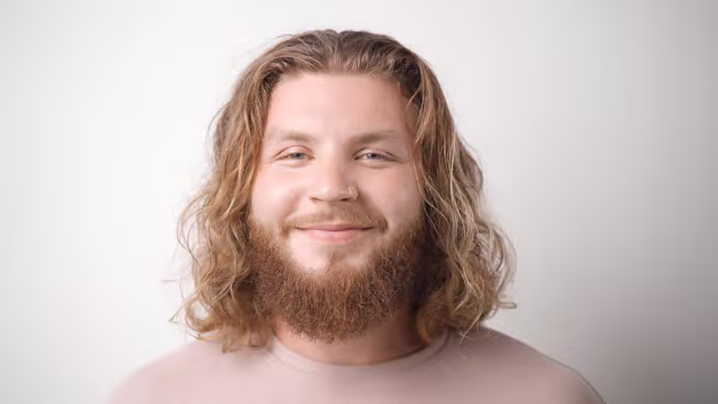 Uomo sorridente con capelli folti dopo trapianto