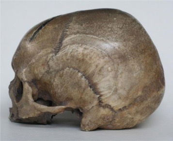 Dagobert's Skull @ Cercle saint Dagobert - more than just a mortal blow ...