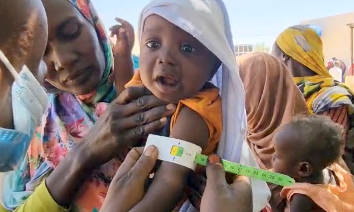 DOCTORS EXPANTIATED THAT USAID CUTS RECENTLY HAS BEEN FATAL IN SUDAN;WHERE CHILDREN CLUNG TO LIFE.