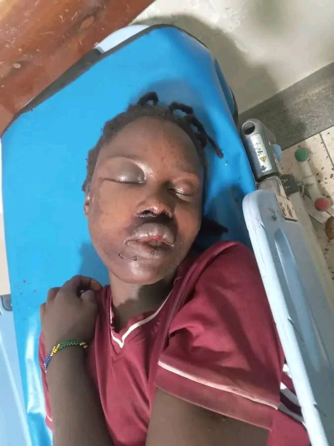 Unidentified Woman Fights for Life After Falling into Septic Tank During Robbery in Arua