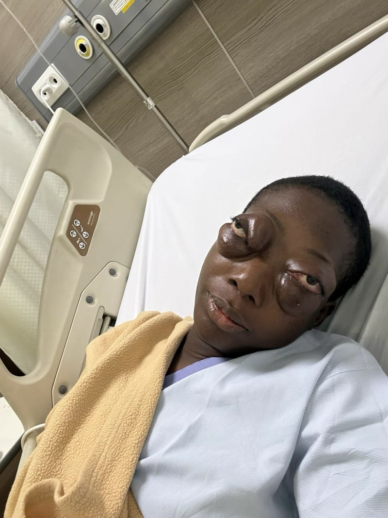 After 20 Years of Suffering, Susan Is Fighting for the Surgery That Could Change Her Life