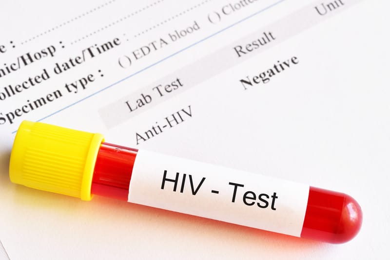 Opinion Letter: Can the Country Sustain ARV Treatment After USAID Funding Cut?