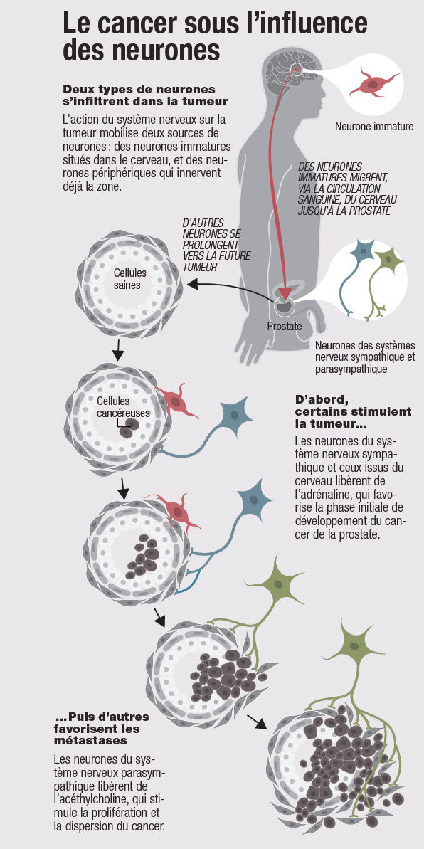 Les tumeurs ont des neurones !