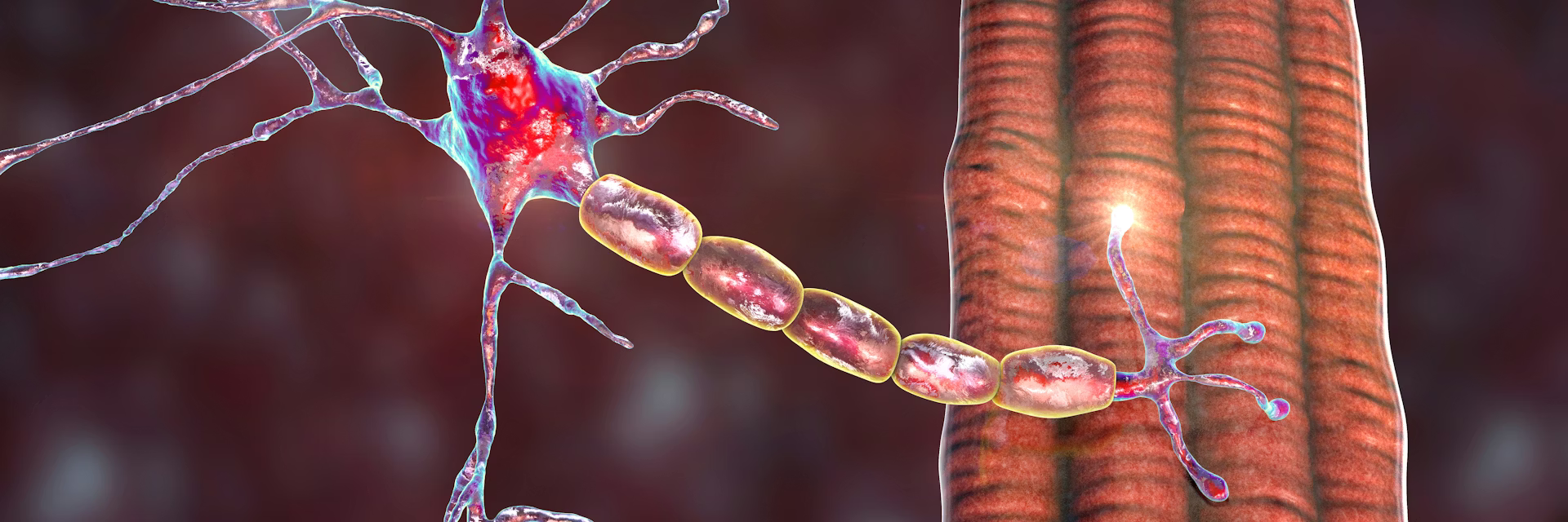 Maladie de Charcot : le mécanisme à l’origine de la forme génétique de la pathologie a été découvert