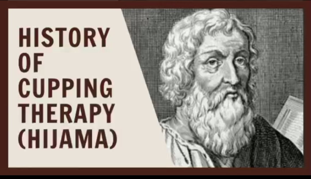 History of Cupping Therapy (Hijama/ Kaipo )