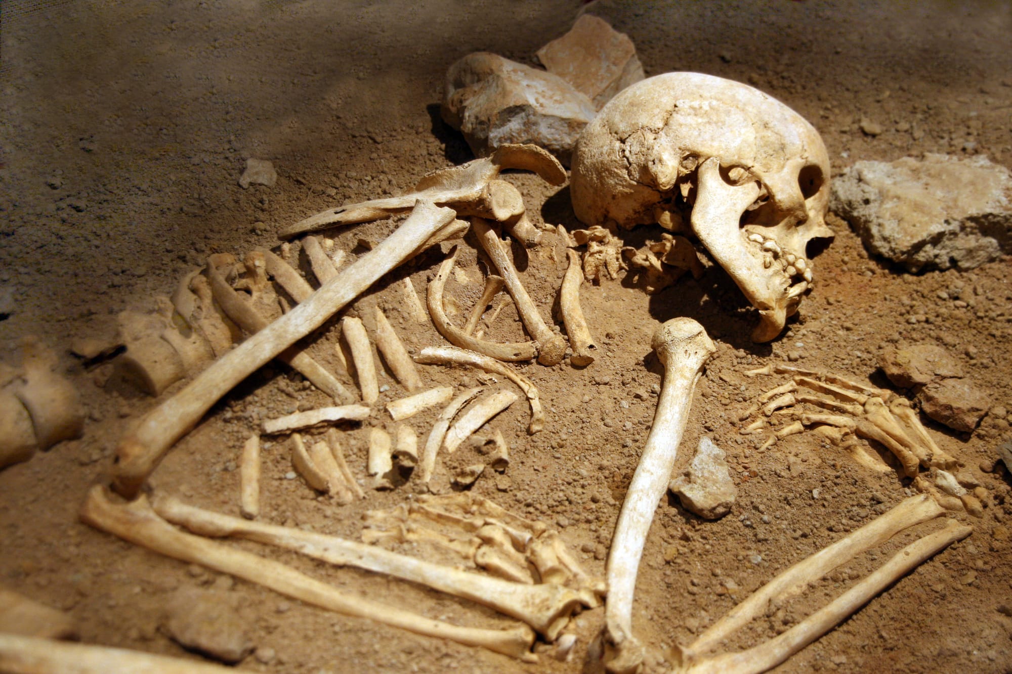 DRY BONES
