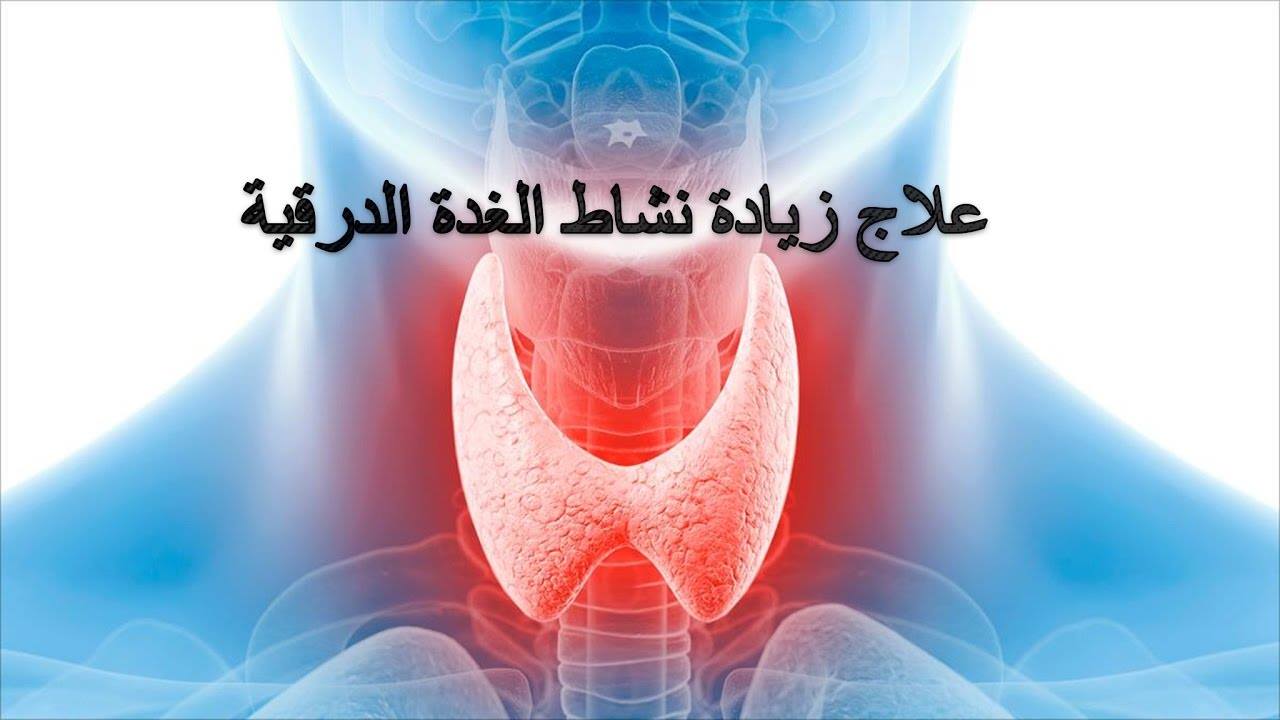 #علاج_نشاط_الغدة_الدرقية
#مرض_جريفز