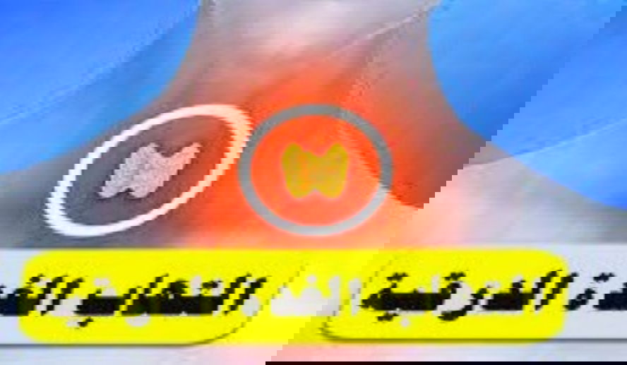 #التهاب #الغدةالدرقية_تحت_الحاد ؟
دي كورفان de Quervain Thyroiditis
ماهو وكيف نتعامل معه ؟
الأخطاء والحقائق ؟