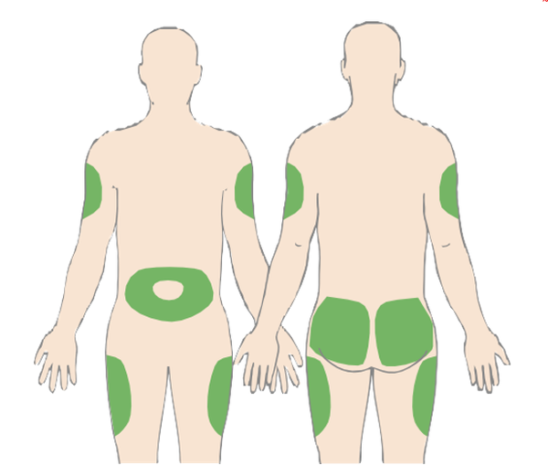 #خطوات_إستخدام_الإنسولين .