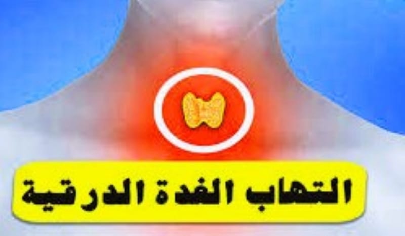 #التهاب #الغدةالدرقية_تحت_الحاد ؟ دي كورفان de Quervain Thyroiditisم