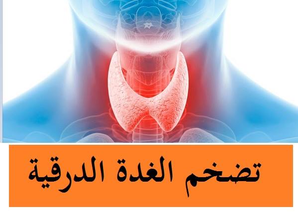 #تضخم_الغدة_الدرقية....؟