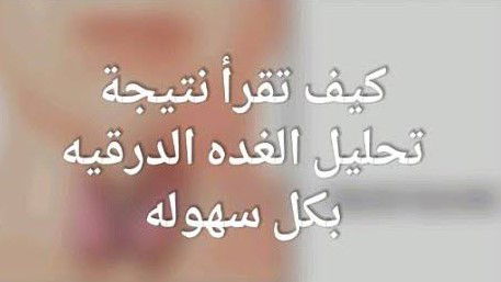 كيفية قراءة #تحاليل_الغدة_الدرقية ؟