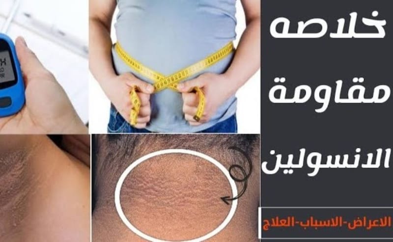 #مقاومة_الإنسولين#حقائق_وأوهام ؟#التشخيص_العلاج#تحليل_مقاومة_إنسولين