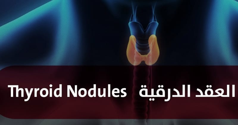 العقد_الدرقية_الساخنة_الحارة#التشخيص_المنسى #حبيبة_اليود_صديقة_الدواء#المسح_الذرى_مهم_ه